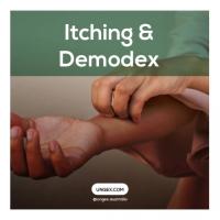 Why Am I Itching So Much?