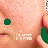 Enlarged Skin Pores