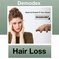 Hair loss