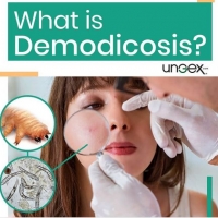 What is Demodicosis?