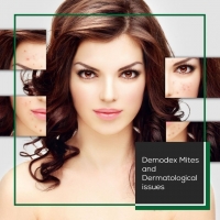 Demodex Mites and Dermatological Issues