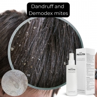 Can dandruff be a sign of mites? ðŸ¤”ðŸ¤”ðŸ¤”