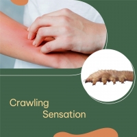 Crawling Sensations