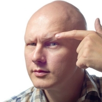 Can Alopecia Universalis be Cured?