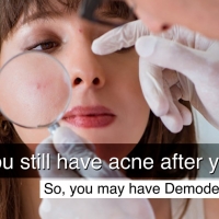 Hard Pimples Solution