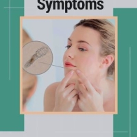 Can Demodex Mites Live in Bedding?ðŸ¤”