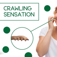 Crawling Sensation